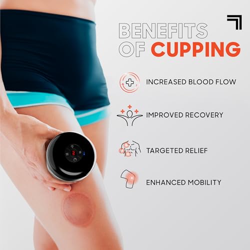 Sharper Image® Pulse Cupping Therapy Massager Set – Heat & Vibration, 4 - Like New