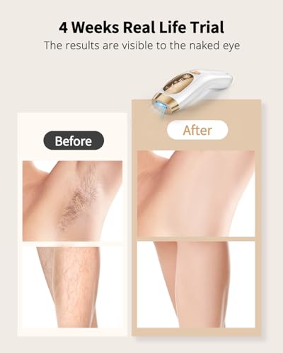 UENMOON Laser Hair Removal for Women & Men IPL Hair Removal, D-1189 - WH/GOLD - Like New