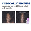 Women's Rogaine 2% Minoxidil Topical Treatment for Hair Thinning and Loss - Brand New