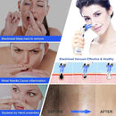SACATO Blackhead Remover Pore Vacuum, Face Suction Pore - Scratch & Dent