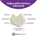 MARS WELLNESS PREMIUM DANCERS PADS FOR BALL OF FEET PAIN 12 PCS RIGHT FOOT - Like New