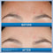 CeraVe Resurfacing Retinol Serum For Post Acne Marks - Like New