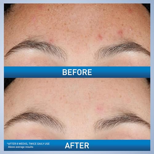 CeraVe Resurfacing Retinol Serum For Post Acne Marks - Like New