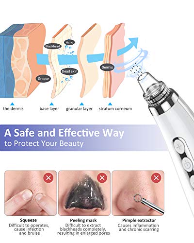 EUASOO BLACKHEAD PORE VACUUM CLEANER REMOVER 2021 UPGRADED - Scratch & Dent