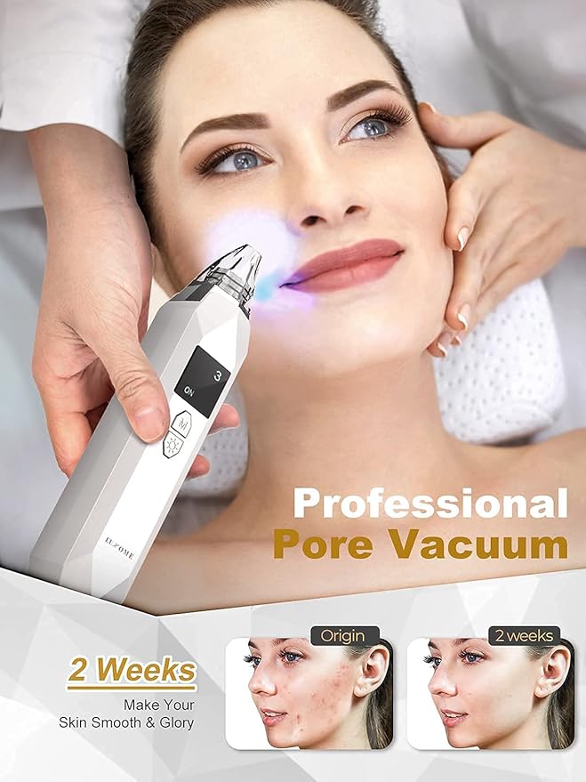 EUHOME Blackhead Remover Pore Vacuum Rechargeable Acne Comedone JHF21 - White Like New