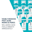 CeraVe Resurfacing Retinol Serum For Post Acne Marks - Like New