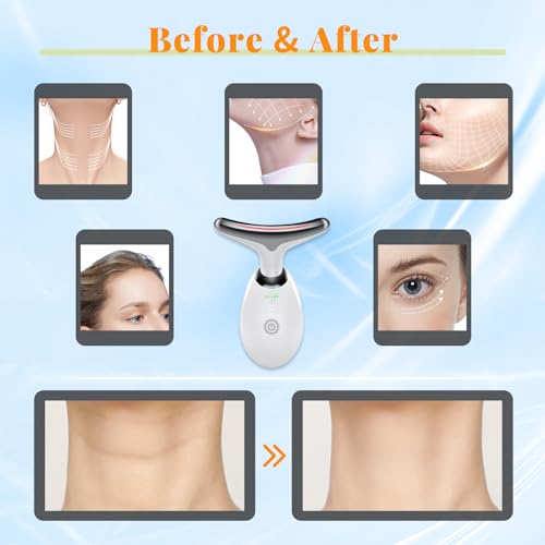 YOLOPIM FACE BEAUTY DEVICE MULTIFUNCTIONAL FACIAL MASSAGER GLOSSY WHITE - Like New