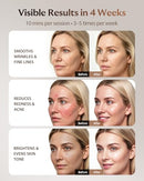 SKB-2418 INDOCTOR XSSNVV RED LIGHT THERAPY FOR FACE 4 MODE CORDLESS LED MASK - Like New