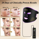 YOEYOU RED LIGHT THERAPY FACE 850NM NEAR INFRARED LED MASK M01-B - BLACK - Like New