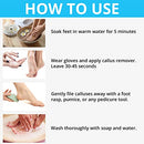 Excuse Me Feet Callus Remover, Liquid Gel for Callus and Corn Remove Dead - Brand New