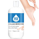 Excuse Me Feet Callus Remover, Liquid Gel for Callus and Corn Remove Dead - Brand New