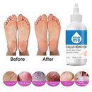 Excuse Me Feet Callus Remover, Liquid Gel for Callus and Corn Remove Dead - Brand New