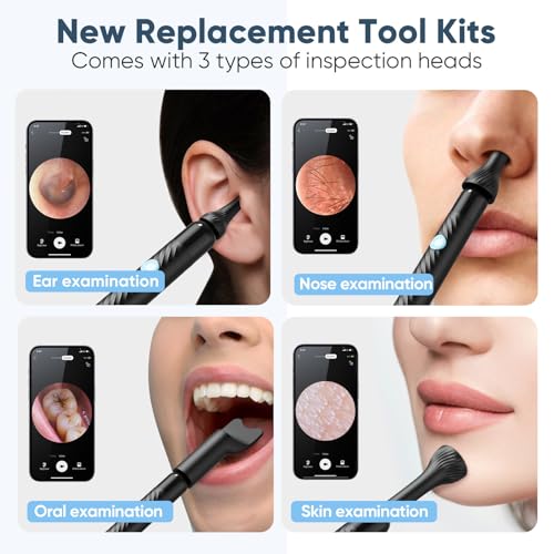 Loyker X6 Ear Wax Removal Tool Camera Ear Cleaner with Camera FSA HSA Store - Like New