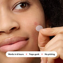 HERO COSMETICS MIGHTY PATCH ORIGINAL PATCH HYDROCOLLOID ACNE PIMPLE PATCH 72CT - Brand New