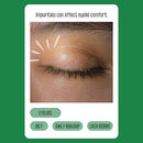 PURELID 100PCs Tea Tree Eyelid Wipes Dry Eyes Allergies Wipes - Brand New