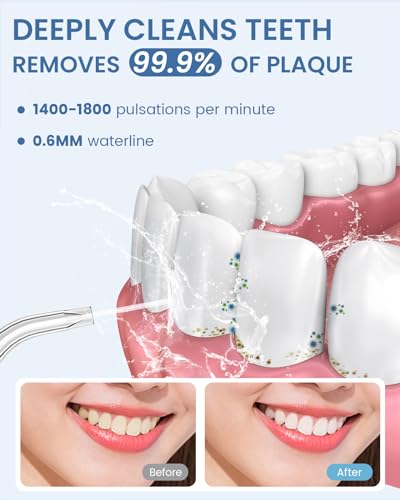 AUIEI-Teeth Pick Cordless Oral Irrigator 300ML 5 Modes Water - Scratch & Dent