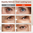 VICONOR RED LIGHT THERAPY FOR EYES, COMFORT UNDER EYE RED LIGHT THERAPY - Like New