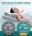 EKIFT EASE NOW CERVICAL NECK PILLOW FOR PAIN RELIEF - GRAY - Like New