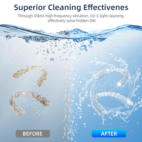 ECOBASIC ULTRASONIC RETAINER CLEANER MACHINE DENTURES MOUTH GUARDS - BLACK - Like New