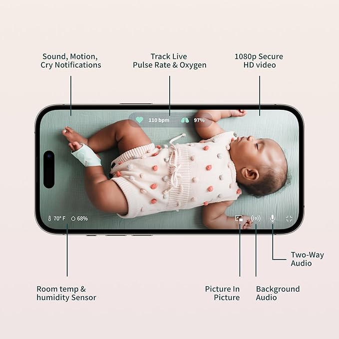 Owlet Dream Duo 2 Smart Baby Monitor 1080p HD Video Dream Sock PS04NMBBJ - MINT - Like New