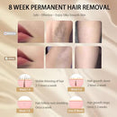 IOUNIYA Laser Hair Removal Device 5 Adjustable Levels MLY-T001 - White/Gold - Like New