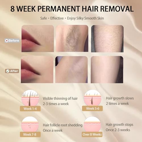 IOUNIYA Laser Hair Removal Device 5 Adjustable Levels MLY-T001 - White/Gold - Like New