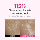 ISOI Blemish Care Up Facial Serum Triple Set Korean Skin Care (2.13 fl. oz) - Brand New