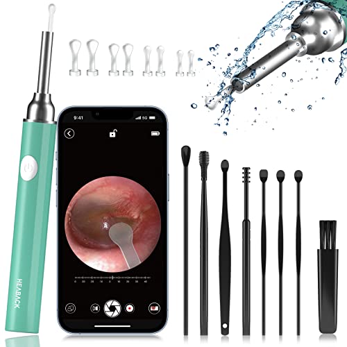 Ear Wax Removal Tool, Smart Ear Cleaner, Ear Camera Scope with Light Smartphone - Like New