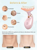 YOLOPIM FACIAL BEAUTY DEVICE MULTIFUNCTIONAL FACIAL SKIN CARE - GLOSSY PINK - Like New