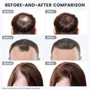 Red Light Therapy for Hair Growth: Cordless Red Light Heating Cap, Rechargeable - Like New