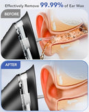 YAKBIO ELECTRIC EAR CLEANER WITH LED DISPLAY, EAR WAX CLEANER - BLACK - Like New